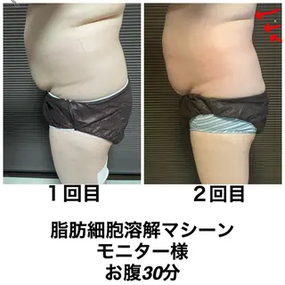 ネイル・エステサロン UILANIのエステ・リラクイメージ