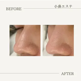 かすみ🌹あま/ エステのエステ・リラクイメージ