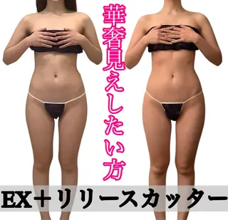 痩身ダイエット&小顔 🩷アールズスリムのエステ・リラクイメージ