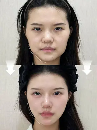 ネイル 愛維美水光専門店 川崎彩鳳のエステ・リラクイメージ