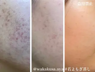 伊藤 彩のエステ・リラクイメージ