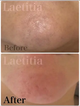レティティア (Laetitia)のエステ・リラクイメージ