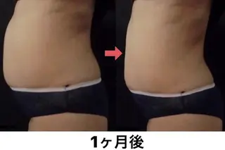 横浜エステサロン R-ing リングのエステ・リラクイメージ