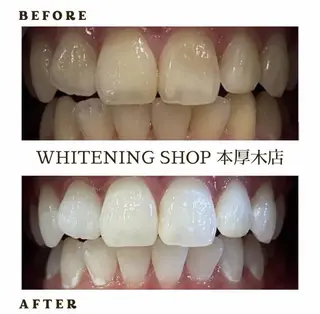 メンズ ホワイトニング ショップ本厚木のその他イメージ