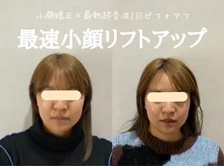 マツエク・マツパ 愛維美水光専門店 川崎彩鳳のエステ・リラクイメージ