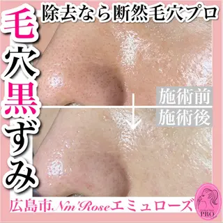 Nm'Rose 段原店のマツエク・マツパデザイン