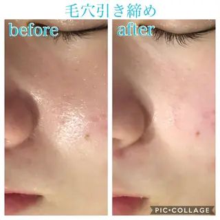 ロング カラー パーマ ヘアアレンジ キッズ ネイル マツエク・マツパ EnsorClair 代表 野口真央のエステ・リラクイメージ