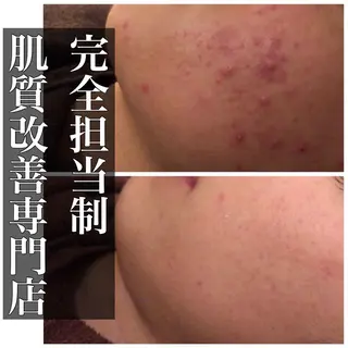 ミディアム カラー パーマ ヘアアレンジ メンズ キッズ ネイル マツエク・マツパ ニキビ・肌質改善専門 ♡人生が変わるサロンのエステ・リラクイメージ