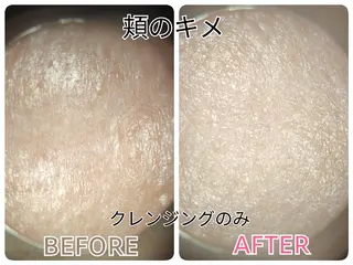 メナード鈴木 麻弓のエステ・リラクイメージ