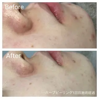 深い肌悩み&早期脱毛 完了サロンのエステ・リラクイメージ