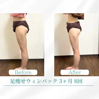 美容鍼サロン ボディコンディションのエステ・リラクイメージ