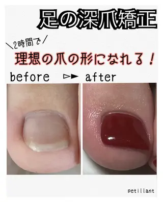 ネイル nail salon petillantのネイルデザイン