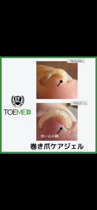 ネイル kicoconail misakoのネイルデザイン