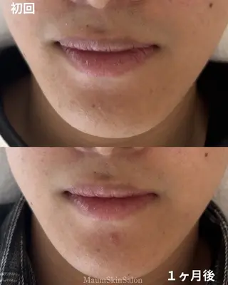 メンズ Maum SkinSalonのエステ・リラクイメージ