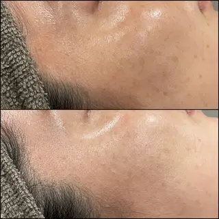 LiZA エステティックサロンのエステ・リラクイメージ
