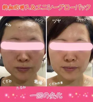 ショート カラー パーマ ヘアアレンジ メンズ キッズ ネイル マツエク・マツパ 痩身&ボディ 結果出し🌟丹野のエステ・リラクイメージ