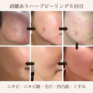 肌質改善サロン ココマヒナのエステ・リラクイメージ