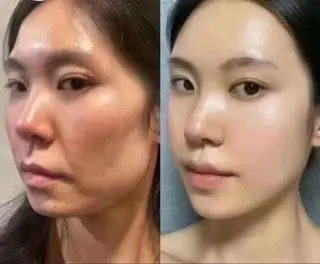 ネイル 愛維美水光専門店 川崎彩鳳のエステ・リラクイメージ