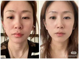 ショート 愛維美水光専門店 川崎彩鳳のエステ・リラクイメージ
