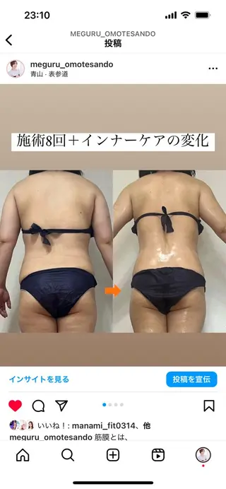 ショート カラー パーマ ヘアアレンジ メンズ 痩身&ボディ 結果出し🌟丹野のエステ・リラクイメージ