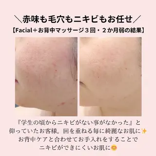 フェイシャル/ボディ /ブライダル山田浩子のエステ・リラクイメージ