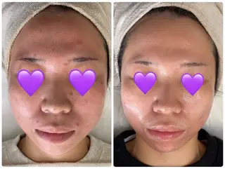 COCO beautyサロンのエステ・リラクイメージ