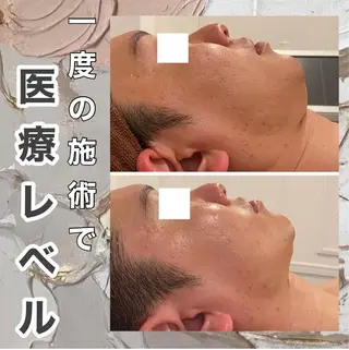 トラブル肌改善🏥 Meow！🫧🫧のエステ・リラクイメージ