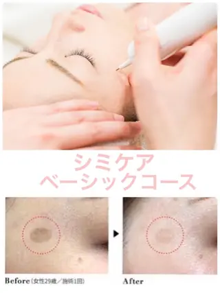 肌質改善サロン BestBelleのエステ・リラクイメージ