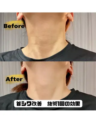ストレートネック専門 店NVI(エヌビ)のエステ・リラクイメージ