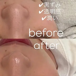 肌管理サロン vidyto MOEのエステ・リラクイメージ