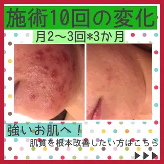ミディアム カラー パーマ ヘアアレンジ メンズ キッズ ネイル マツエク・マツパ ニキビ・肌質改善専門 ♡人生が変わるサロンのエステ・リラクイメージ