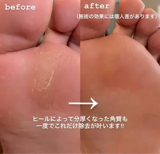 ネイル Ella beautyのその他イメージ