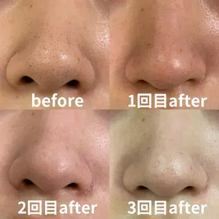 mish eyebrowのエステ・リラクイメージ