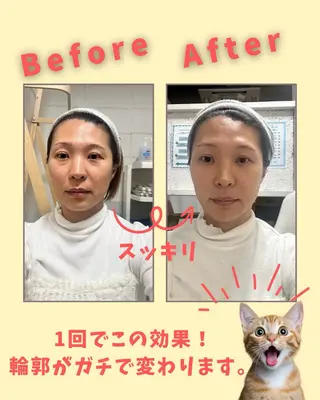 セルフ脱毛・光エステ LISALISAのエステ・リラクイメージ