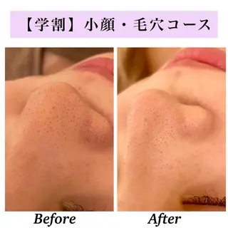 Bellesthe (ベルエステ)のエステ・リラクイメージ
