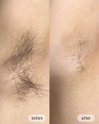 LaVibe ann.のエステ・リラクイメージ