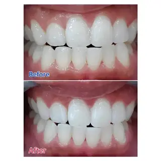 M渋谷 セルフホワイトニングのエステ・リラクイメージ