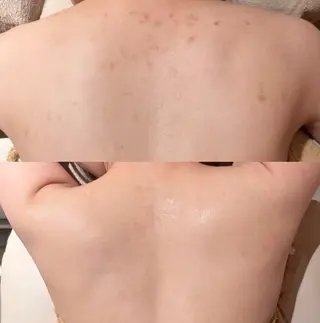 森 美優のエステ・リラクイメージ