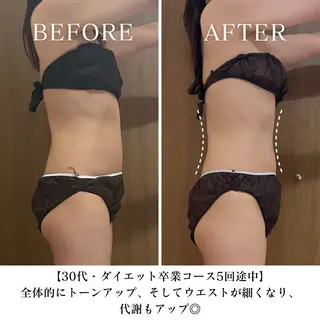 【三軒茶屋/下馬】 本格痩身・よもぎ蒸しのエステ・リラクイメージ
