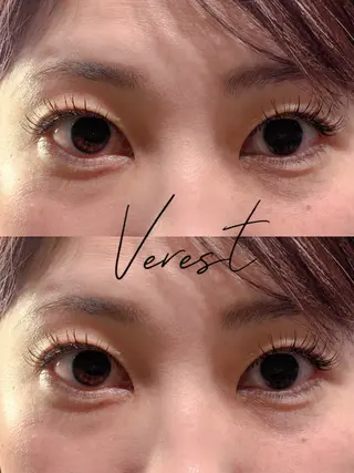 マツエク・マツパ トップアイリスト Verestのマツエク・マツパデザイン