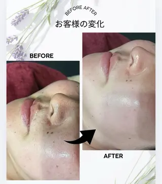 Lino 韓国コルグン×美肌のエステ・リラクイメージ
