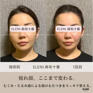 麻布十番小顔コルギ 姿勢矯正リアン💗のエステ・リラクイメージ