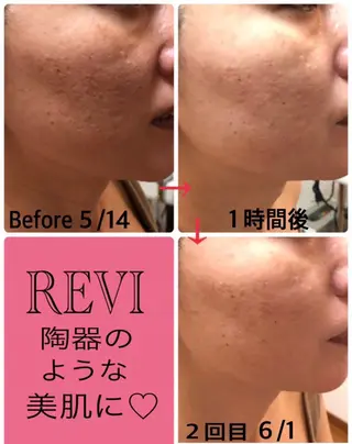 美肌❤️美眉 結果重視サロン✨のエステ・リラクイメージ