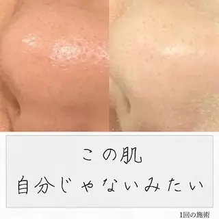 ニキビ経験者が施術 する専門サロン🌻のエステ・リラクイメージ