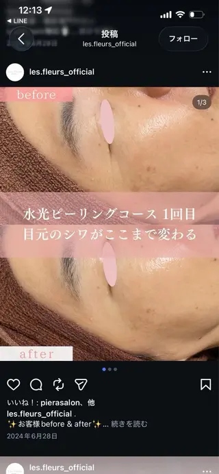 脱毛/ピーリング Lokahiのエステ・リラクイメージ