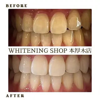 メンズ ホワイトニング ショップ本厚木のその他イメージ