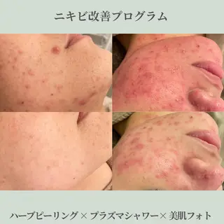 メゾンリュバン 天王寺店のエステ・リラクイメージ