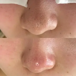 repos ルポのマツエク・マツパデザイン