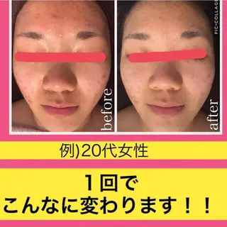 ミディアム カラー パーマ ヘアアレンジ メンズ キッズ ネイル マツエク・マツパ ニキビ・肌質改善専門 ♡人生が変わるサロンのエステ・リラクイメージ