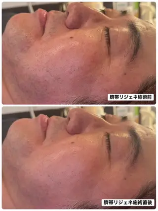 幹細胞専門サロン REGENE甲府の眉毛・アイブロウイメージ